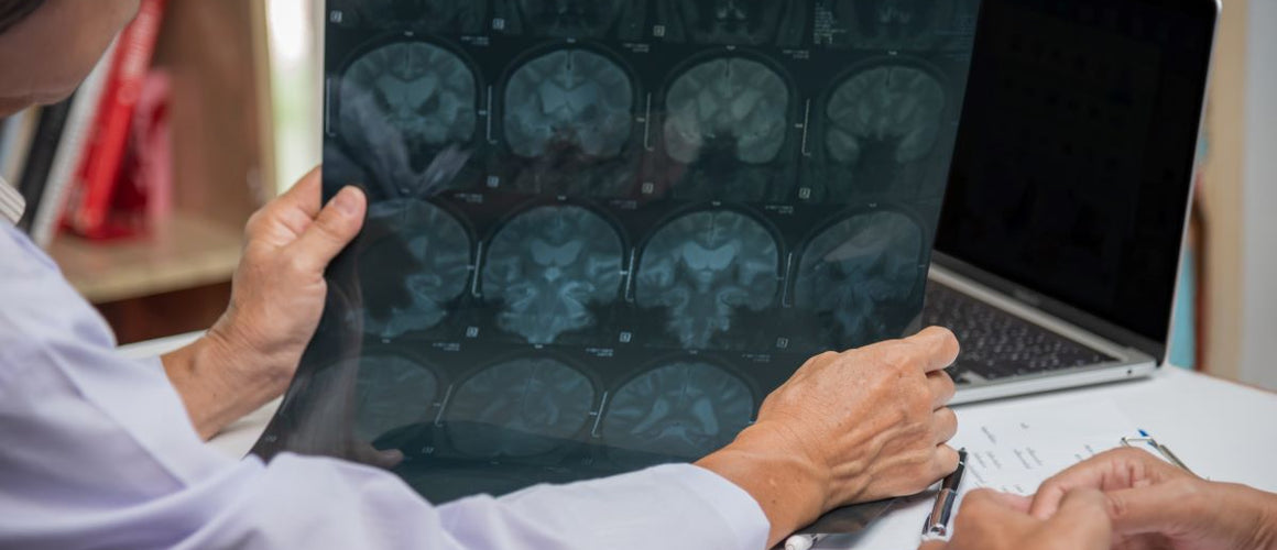 Doctor checking brain x-ray of a Parkinson's patient