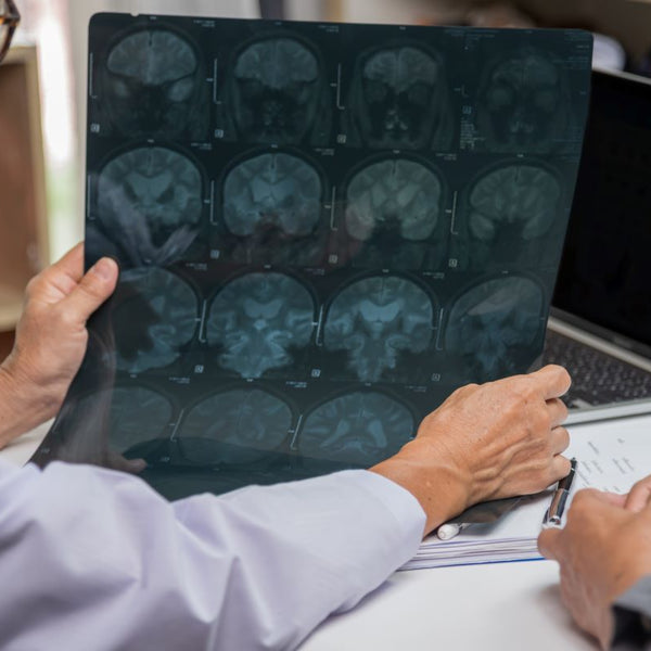 Doctor checking brain x-ray of a Parkinson's patient