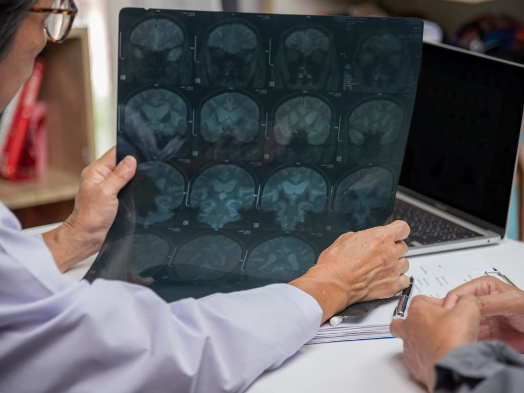 Doctor checking brain x-ray of a Parkinson's patient