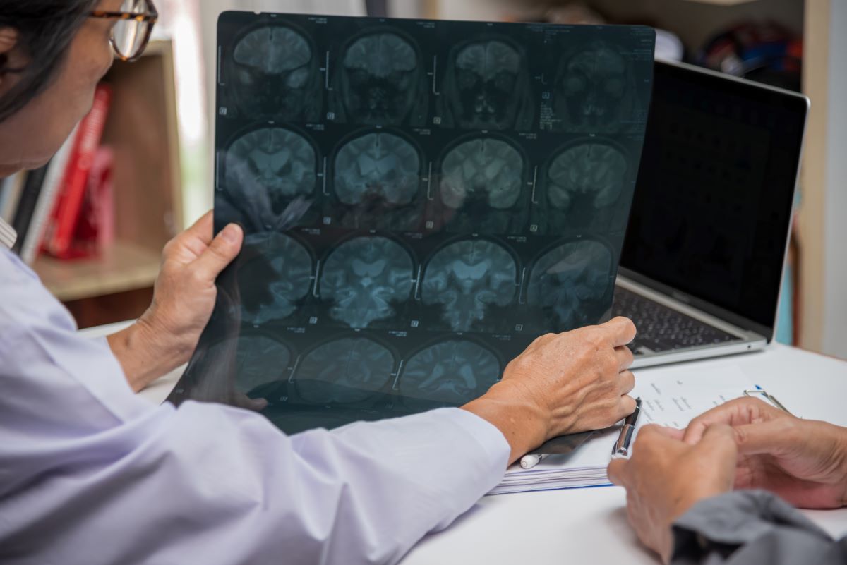Doctor checking brain x-ray of a Parkinson's patient
